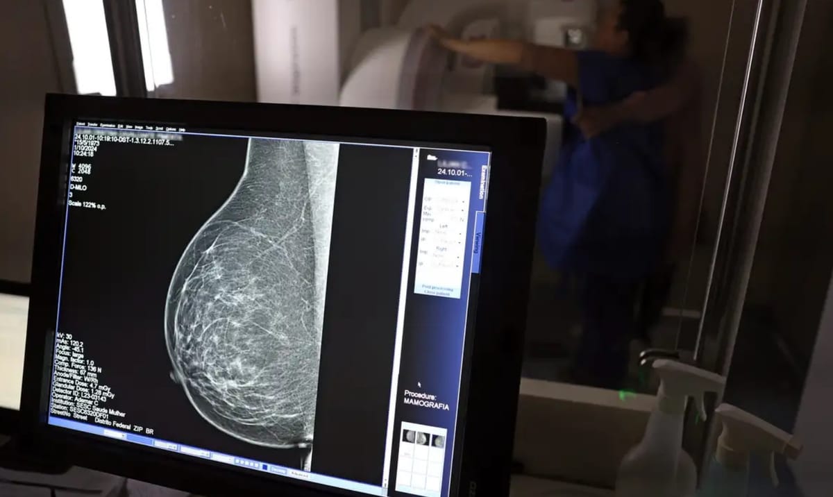 Projeto prevê distribuição de sutiãs para mulheres que passaram por mastectomia