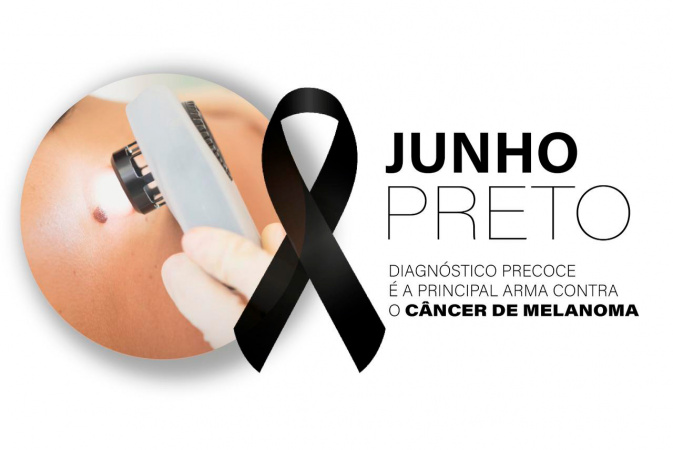 Diagnóstico precoce é a principal arma contra o melanoma, tipo mais agressivo de câncer de pele